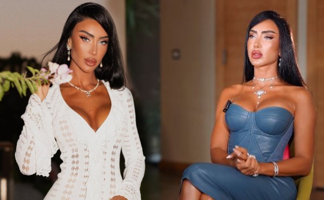  Diana 3 ay İstanbulda müalicə alıb