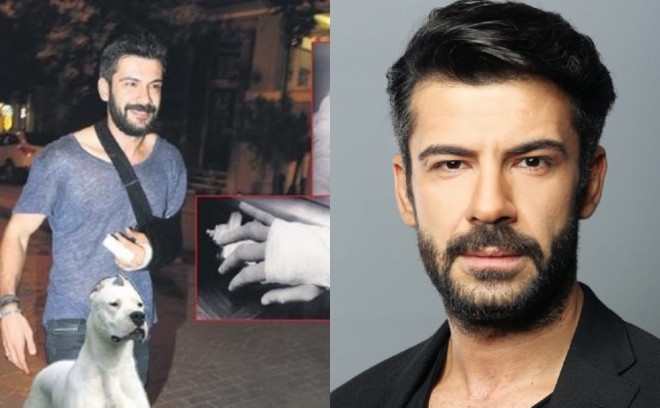 Aktyora it hücum etdi - foto