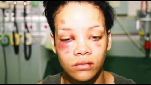 Kris Braun Rihannanı döydüyü üçün problem yaşayır