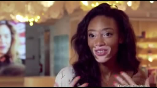 Model Şantel Braun-Yanq: “Bədənimdəki ləkələrlə barışdım”