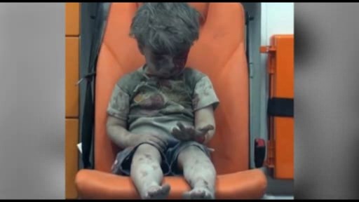 Gülben Ergen: “Kiçik əllərinə bulaşan qan dünyanın utancı olsun”