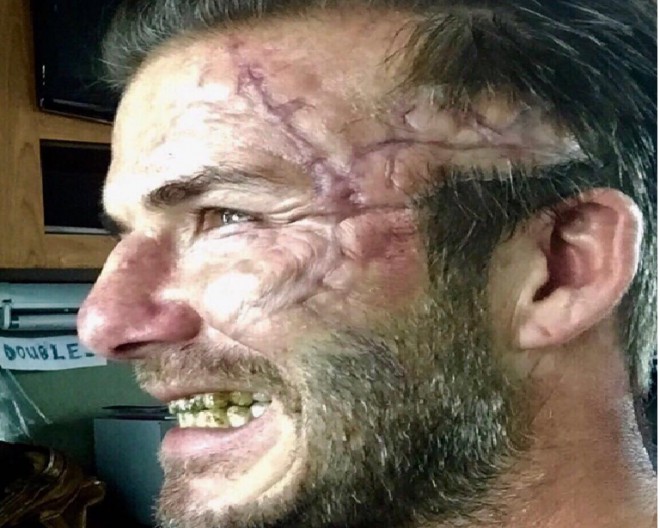 Bekhem pərəstişkarlarını təşvişə saldı&nbsp;