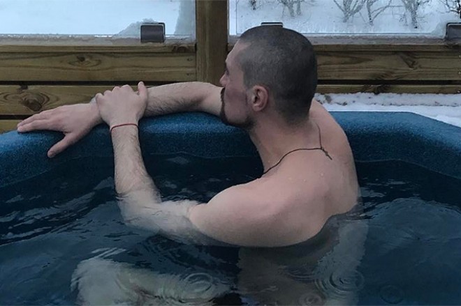 Dima Bilan tanınmaz hala düşdü - foto