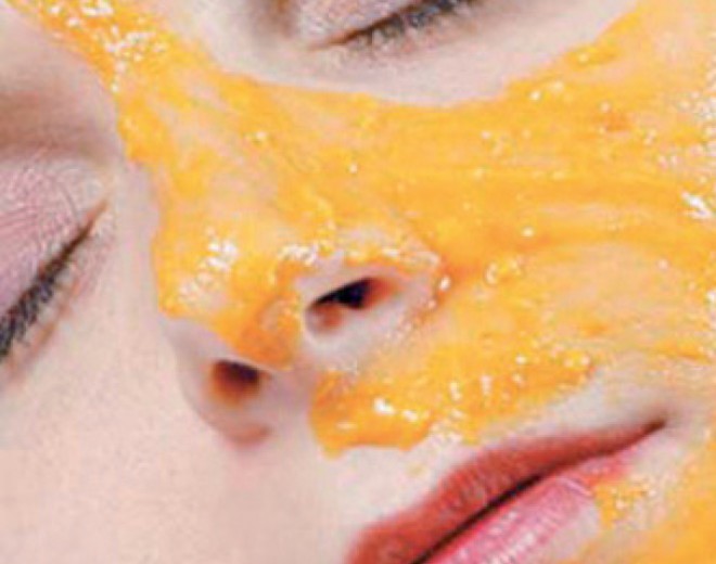 Portağal maskası ilə sızanaqlardan qurtulun