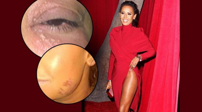 İngiltərəli aktrisa şiddətə məruz qaldı