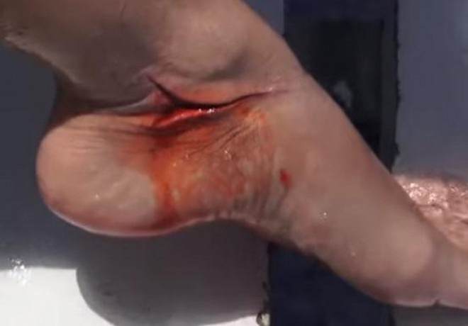 Amerikalı aktrisa köpək balığının qurbanı oldu