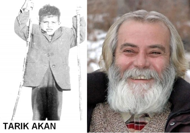 Əvvəlki hallarından əsər-əlamət qalmayan 10 məşhur