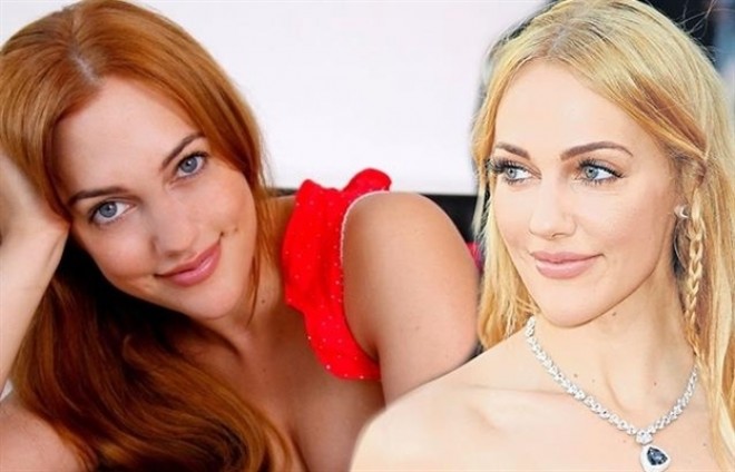 Məryəm Üzərli estetik əməliyyat etdirib?