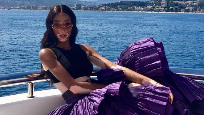 Dünyanın ən qəribə modeli yaxtada fotosessiya etdirdi - fotolar