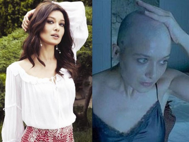 Rollarına görə keçəl olan 12 məşhur