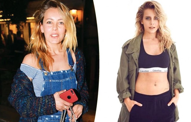 Əməliyyat etdirdiyi deyilən aktrisadan açıqlama