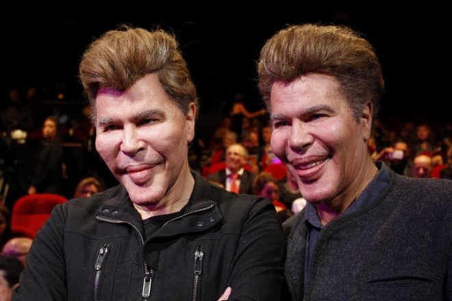 Aparıcıların plastik əməliyyatları onları qorxunc hala saldı - fotolar