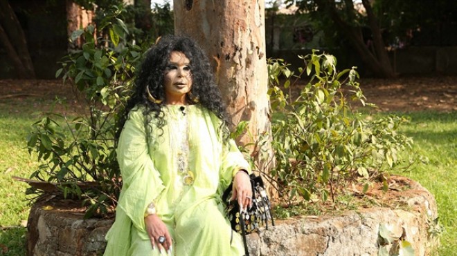 Bülənt Ərsoy: “Mənim zəhərim ilanı öldürdü”