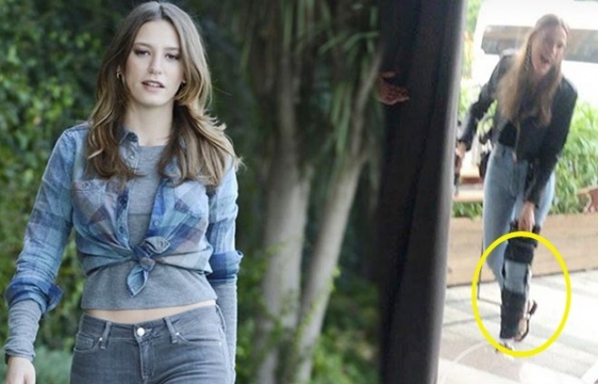 Serenay Sarıkaya sevgilisinin doğum gününə ayağı sarıqlı getdi