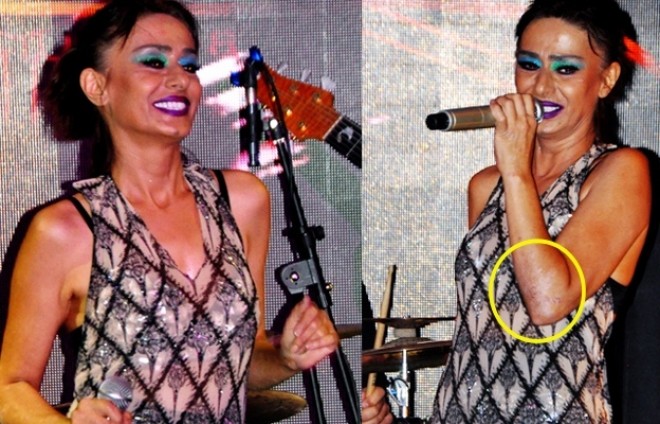 Yıldız Tilbe sevənlərini kədərləndirdi