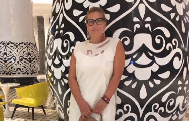 Xanbabayevanı tanımayacaqsınız - foto