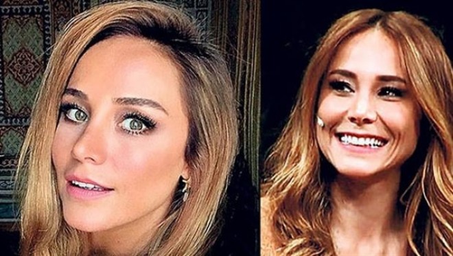 Burçin Terzioğlu botoks etdirdi