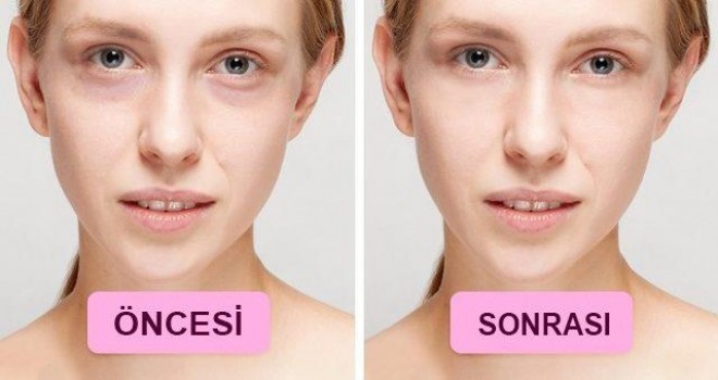 Gözaltı üçün maska