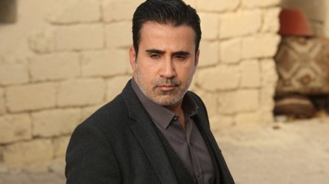 Əmrah üzünə botoks etdirib