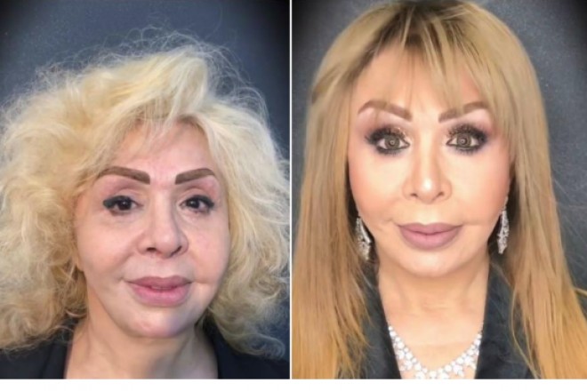 Rühəngiz Allahverdiyeva tam dəyişdi