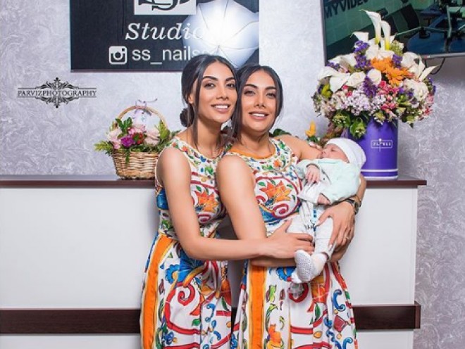 Əkiz müğənnilərin uşaq sevgisi -&nbsp;foto