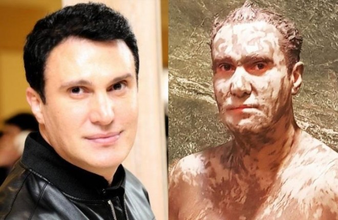 Müğənninin tanınmaz halını bəyəndilər