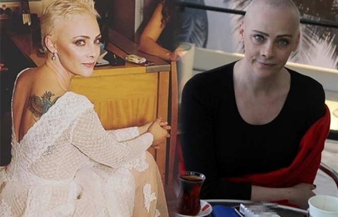 Aktrisa başını keçəl qırxdırdı - foto