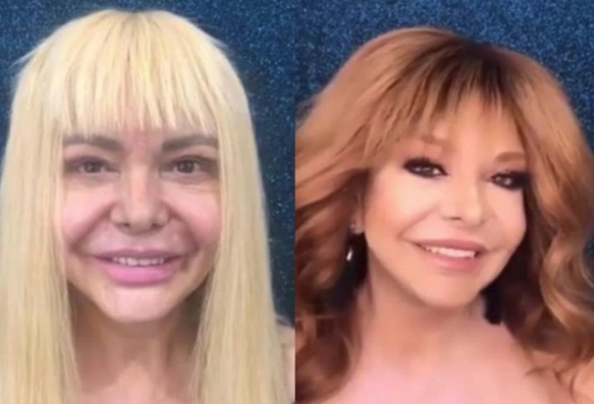 Müğənni Cəmilə dəyişdi və təəccübləndirdi