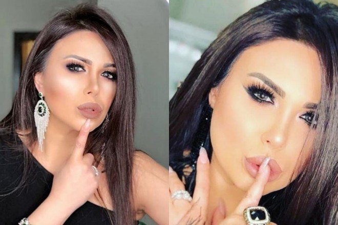 Günel Ələkbərova dodaqlarına görə tənqid olundu