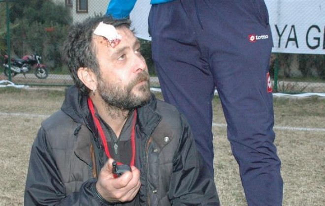 Aktyorun Bodrumda dişini qırdılar - foto