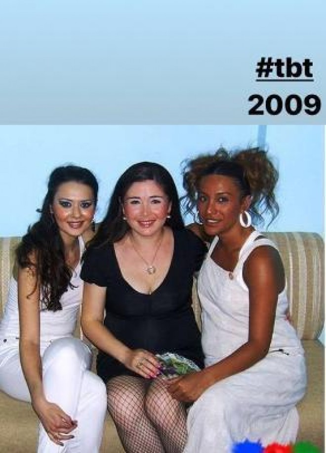 Ana olmağa hazırlaşan rəqqasənin arxiv şəkilləri