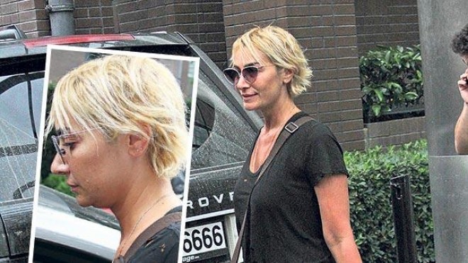 Günəş müğənnini xəstəxanalıq etdi