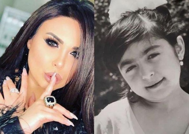 Günelin dodaqları müzakirə obyektinə çevrildi