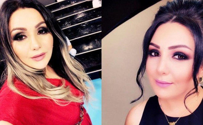 Aygün Mahmudova görünüşünü dəyişdi