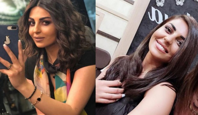 Gülay Zeynallı xarici görünüşündə dəyişiklik edib - foto