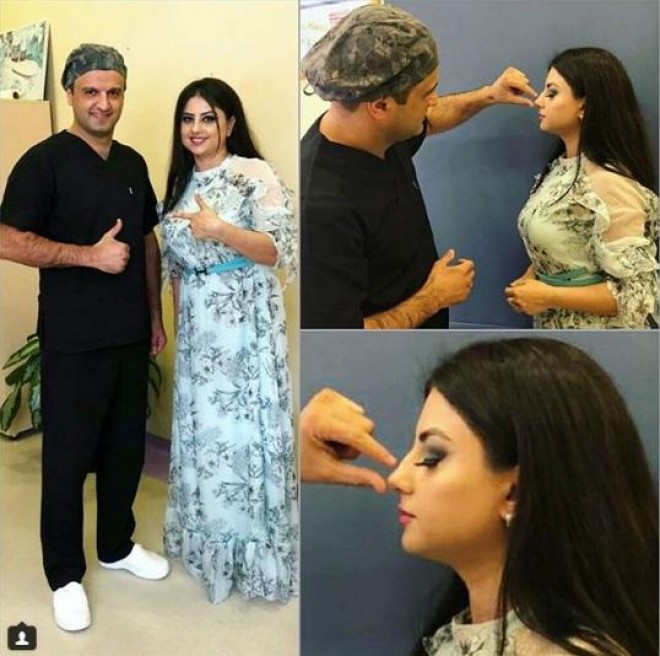 Aparıcı - aktrisa plastik əməliyyata hazırlaşır - foto