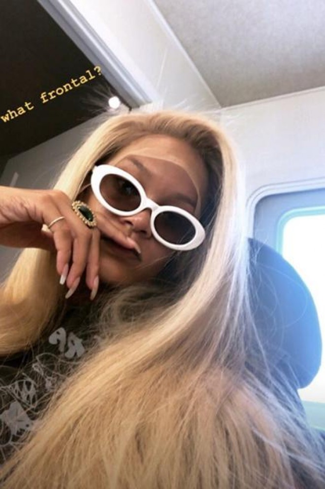 Dünya ulduzu görünüşünü dəyişdi - foto