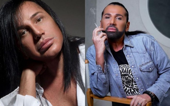 Samir Bağırovun yeni görünüşü bəyənilmədi - foto