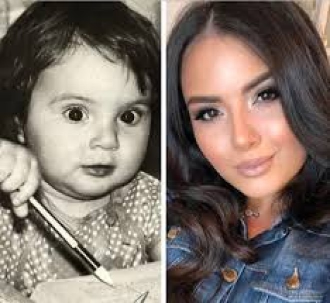 Aysel Teymurzadənin uşaqlıq şəkli&nbsp;