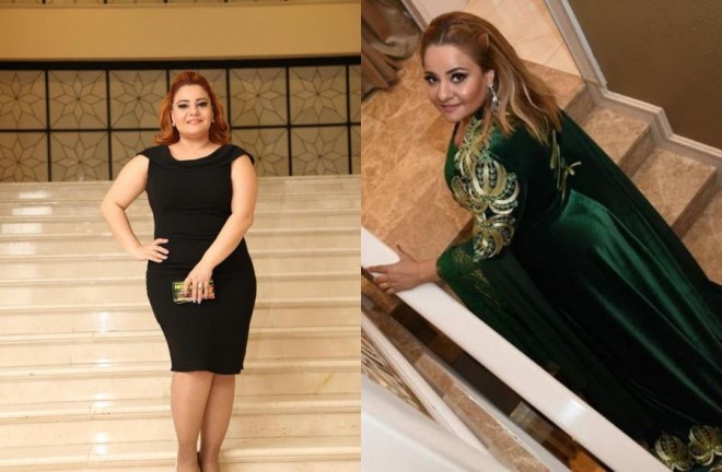 Aktrisa 9 kiloqram arıqladı&nbsp;- foto