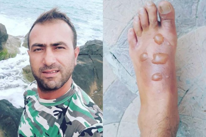 "Cin" ayağını qazana salıb yandırdı - foto