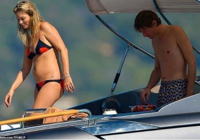 Model pis vərdişlərdən imtina etdi&nbsp;- foto