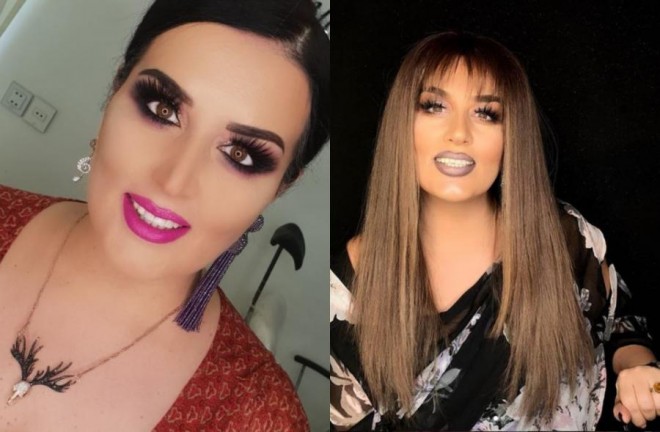 Elza Seyidcahanın görünüşü ciddi dəyişdi&nbsp;