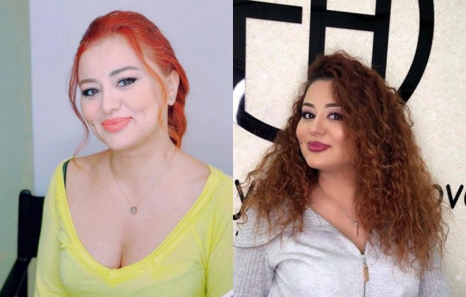 Vəfanın görünüşü təəccüb doğurdu - foto