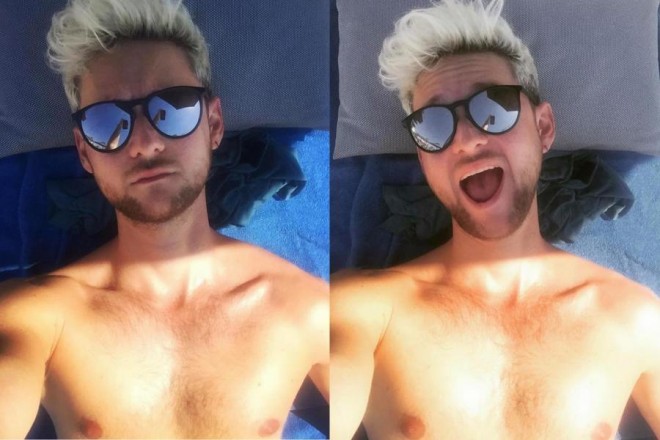 “Eurovision 2011” qalibinin yarıçılpaq şəkilləri