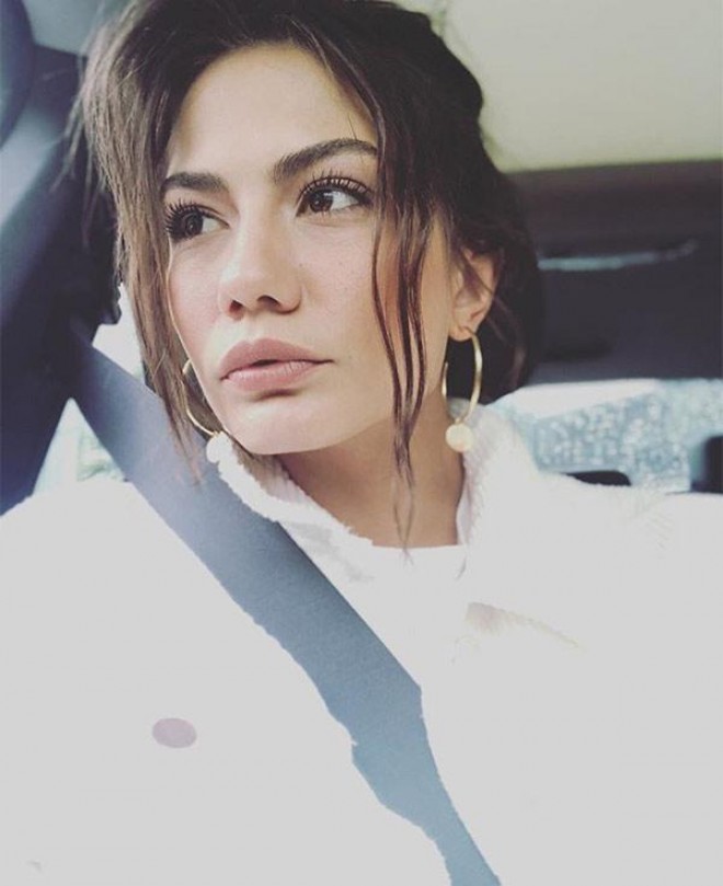 Aktrisa çənəsinə botoks etdirdi