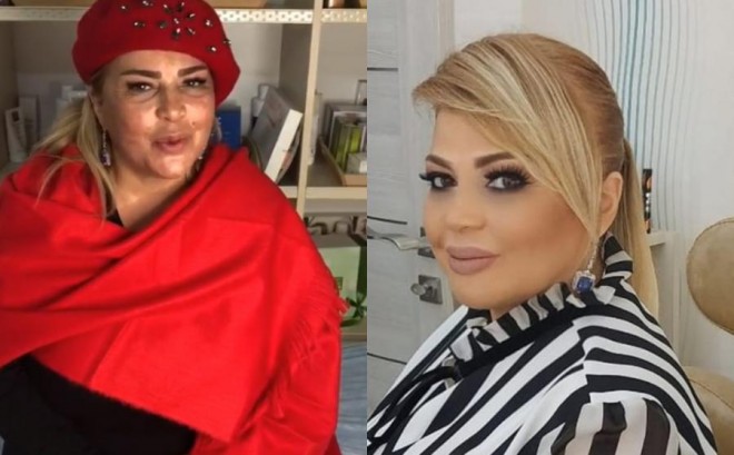 Mətanət İsgəndərlinin makiyajsız şəkli