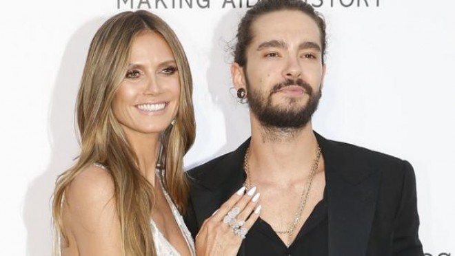 Model sevənlərini təəccübləndirdi - foto