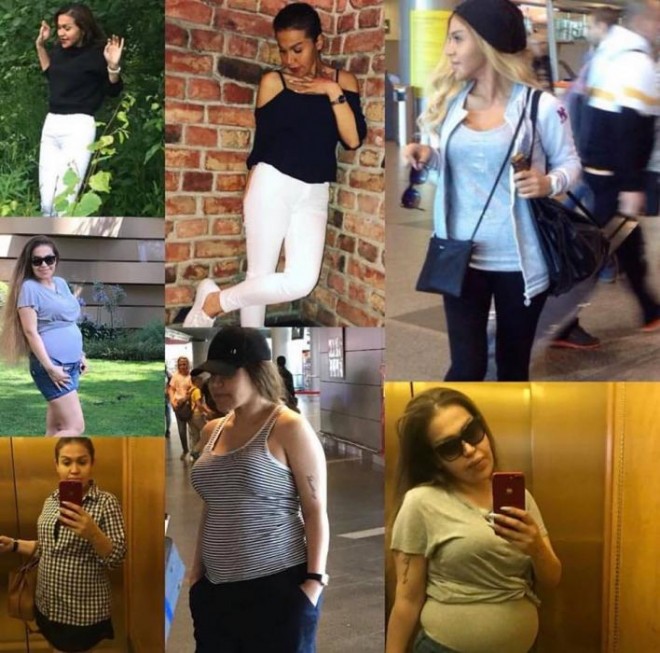 Müğənni Rəqsanə çəkidən əziyyət çəkir