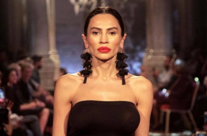  Günayın yanaqları qabarıq göründü - foto